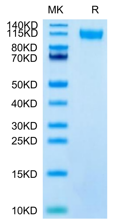 SARS-CoV-2 Spike S1 (Lambda C.37) on Tris-Bis PAGE under reduced condition. The purity is greater than 95%.Recombinant SARS-CoV-2 Spike S1 (Lambda C.37) Protein, Active