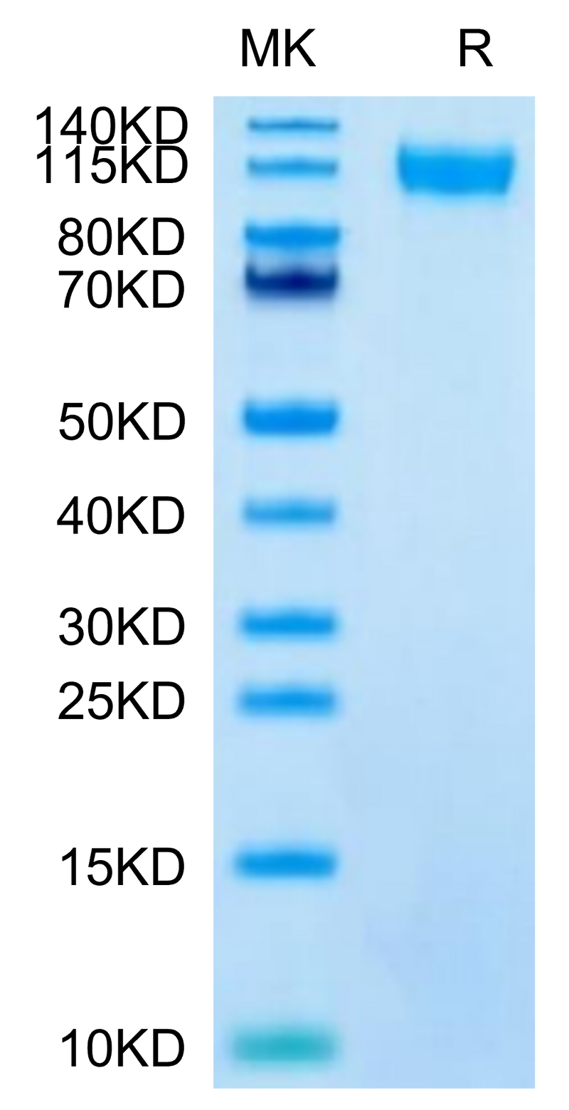 SARS-CoV-2 Spike S1 (Lambda C.37) on Tris-Bis PAGE under reduced condition. The purity is greater than 95%.Recombinant SARS-CoV-2 Spike S1 (Lambda C.37) Protein, Active
