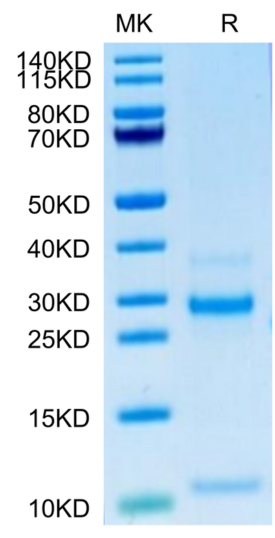 Human Notch 3 on Tris-Bis PAGE under reduced condition. The purity is greater than 95%.Recombinant Human Notch 3 Protein, Active