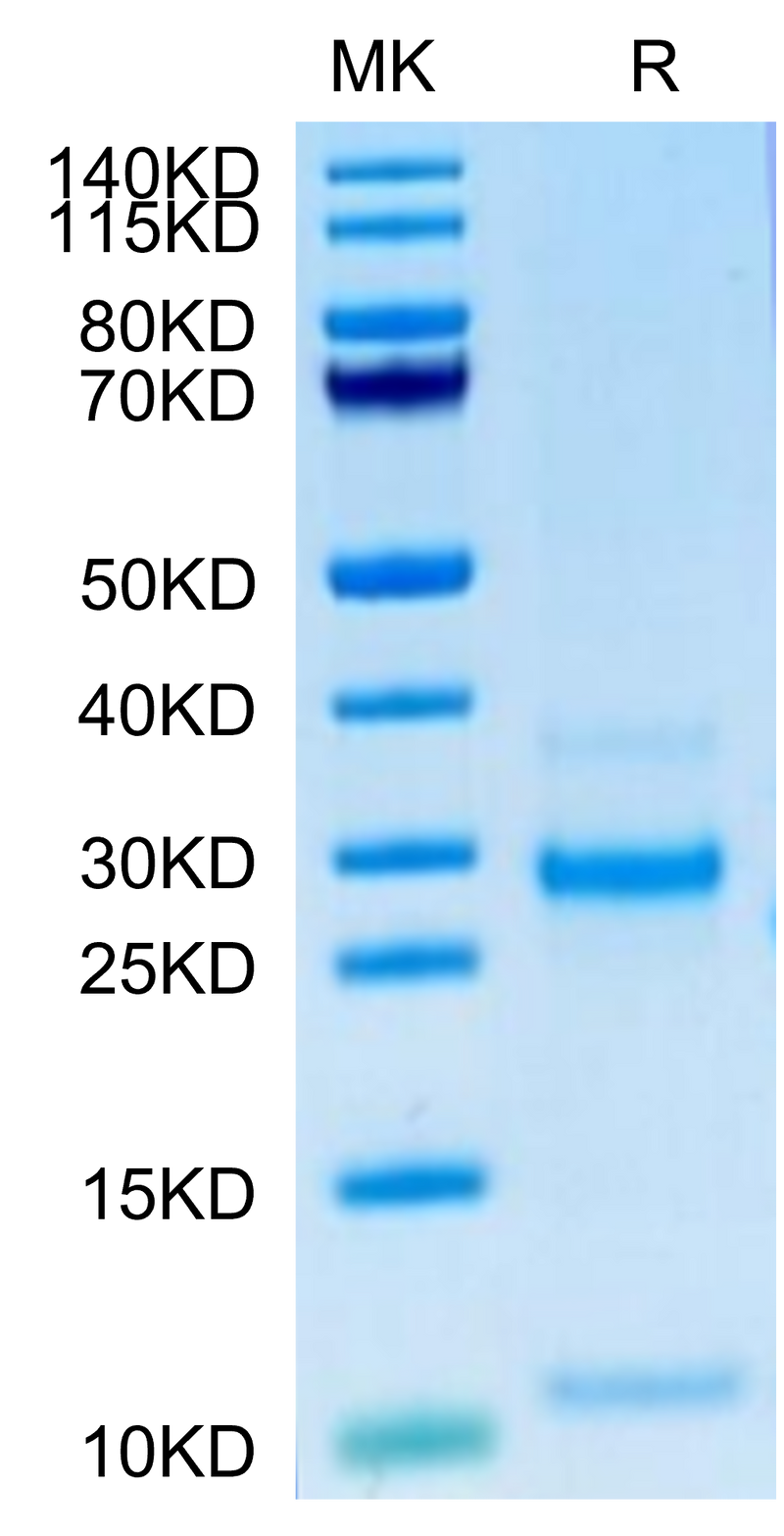 Human Notch 3 on Tris-Bis PAGE under reduced condition. The purity is greater than 95%.Recombinant Human Notch 3 Protein, Active