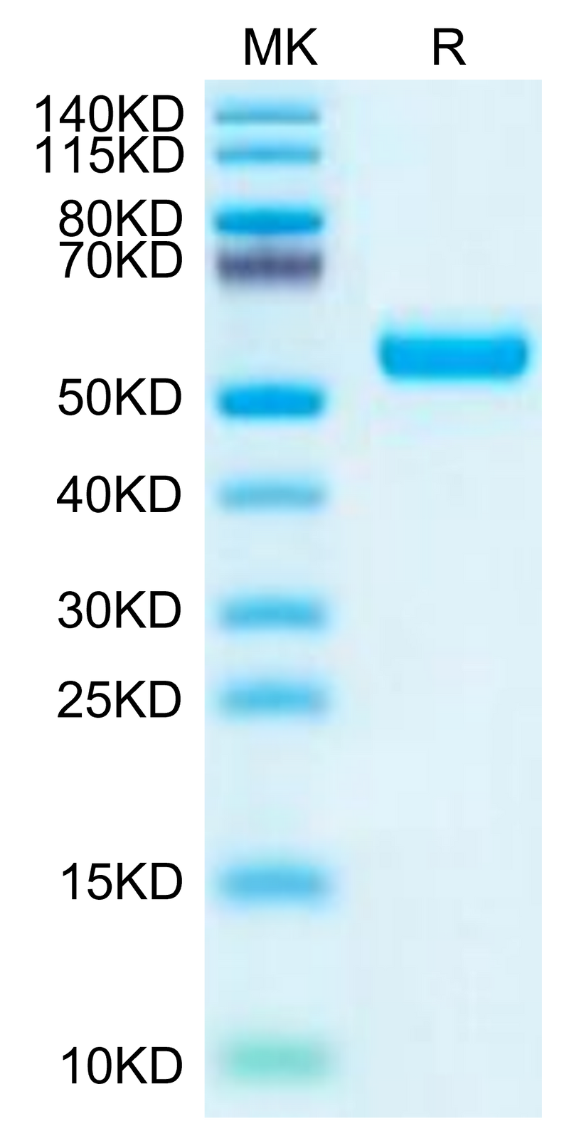 Mouse LRP10 on Tris-Bis PAGE under reduced condition. The purity is greater than 95%.Recombinant Mouse LRP10 Protein