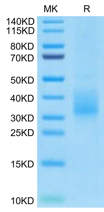 Biotinylated Human LILRB4 Domain 2 on Tris-Bis PAGE under reduced condition. The purity is greater than 95%.Biotinylated Human LILRB4/CD85k/ILT3 SR&Domain 2 Protein