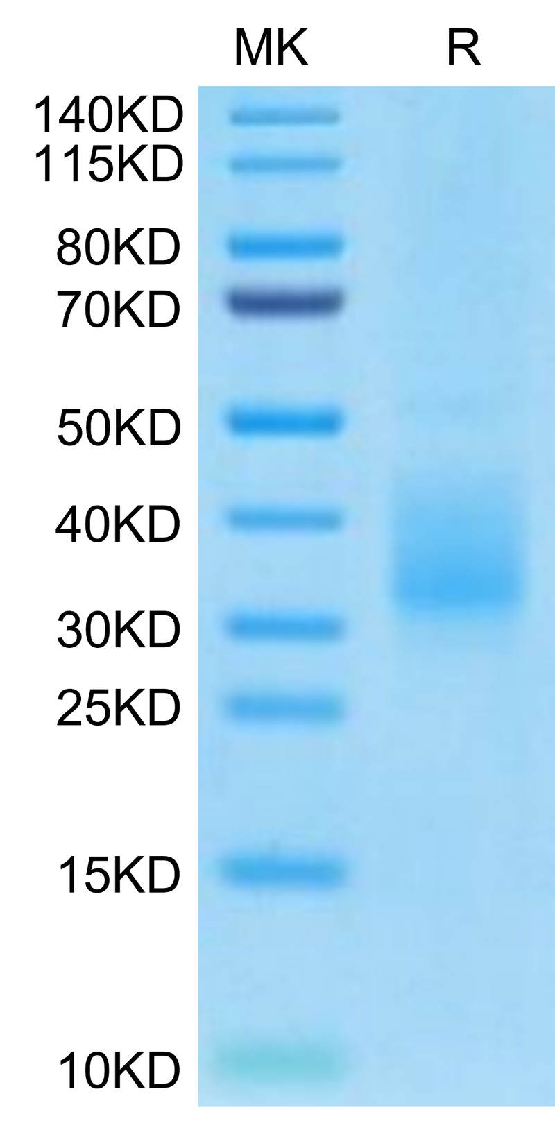 Biotinylated Human LILRB4 Domain 2 on Tris-Bis PAGE under reduced condition. The purity is greater than 95%.Biotinylated Human LILRB4/CD85k/ILT3 SR&Domain 2 Protein
