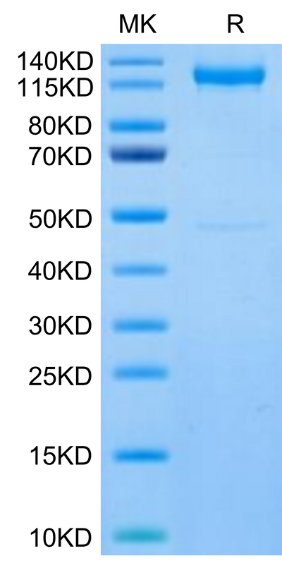 Human CDH17 on Tris-Bis PAGE under reduced condition. The purity is greater than 95%.Recombinant Human CDH17/Cadherin 17 Protein, Active