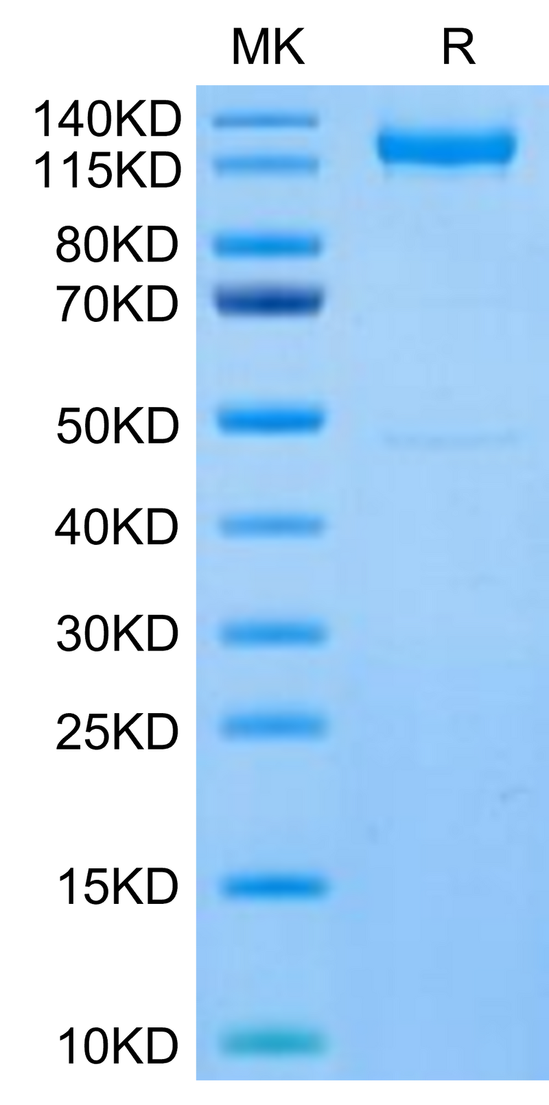 Human CDH17 on Tris-Bis PAGE under reduced condition. The purity is greater than 95%.Recombinant Human CDH17/Cadherin 17 Protein, Active