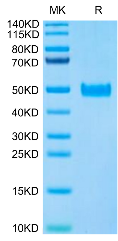 Human PAI-1 on Tris-Bis PAGE under reduced condition. The purity is greater than 95%.Recombinant Human PAI-1 Protein