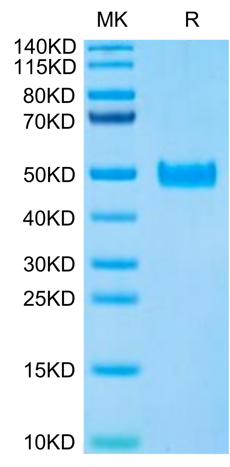 Human PAI-1 on Tris-Bis PAGE under reduced condition. The purity is greater than 95%.Recombinant Human PAI-1 Protein