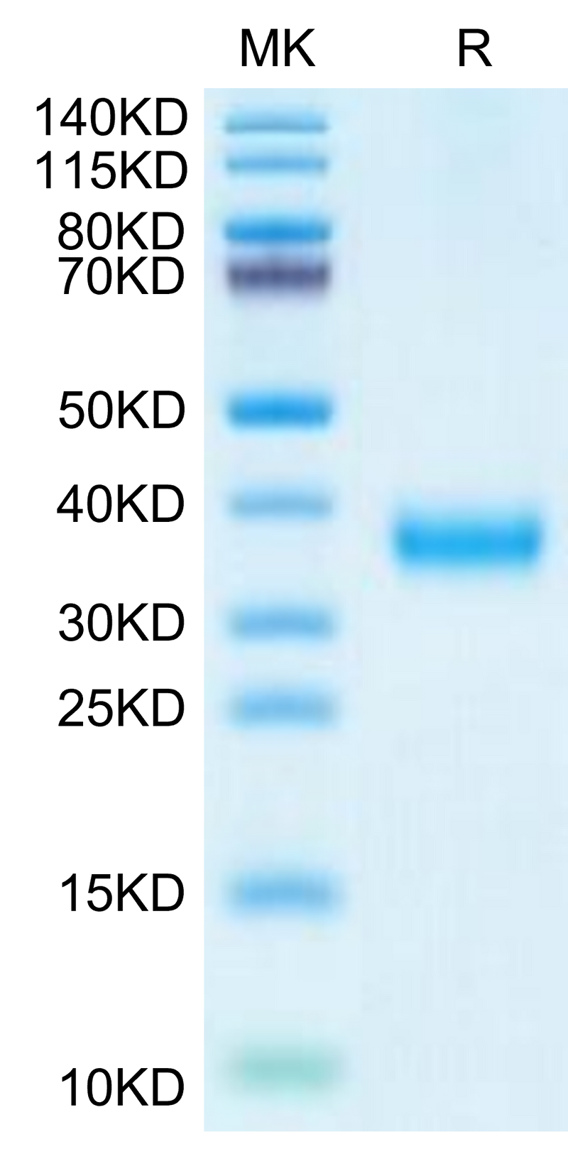 SARS-CoV-2 Spike RBD (Delta plus AY.1/AY.2) on Tris-Bis PAGE under reduced condition. The purity is greater than 95%.Recombinant SARS-CoV-2 Spike RBD (Delta plus AY.1/AY.2) Protein, Active