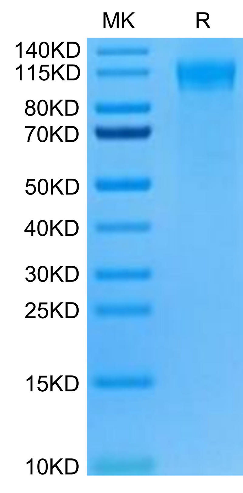 Mouse FLT3 on Tris-Bis PAGE under reduced condition. The purity is greater than 95%.Recombinant Mouse FLT3/Flk-2 Protein