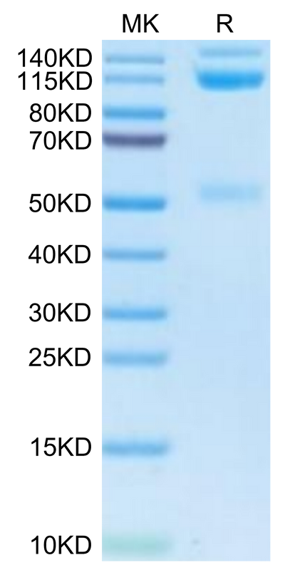 Human ITGAV&ITGB3 on Tris-Bis PAGE under reduced condition. The purity is greater than 95%.Recombinant Human Integrin alpha V beta 3 (ITGAV&ITGB3) Heterodimer Protein, Active