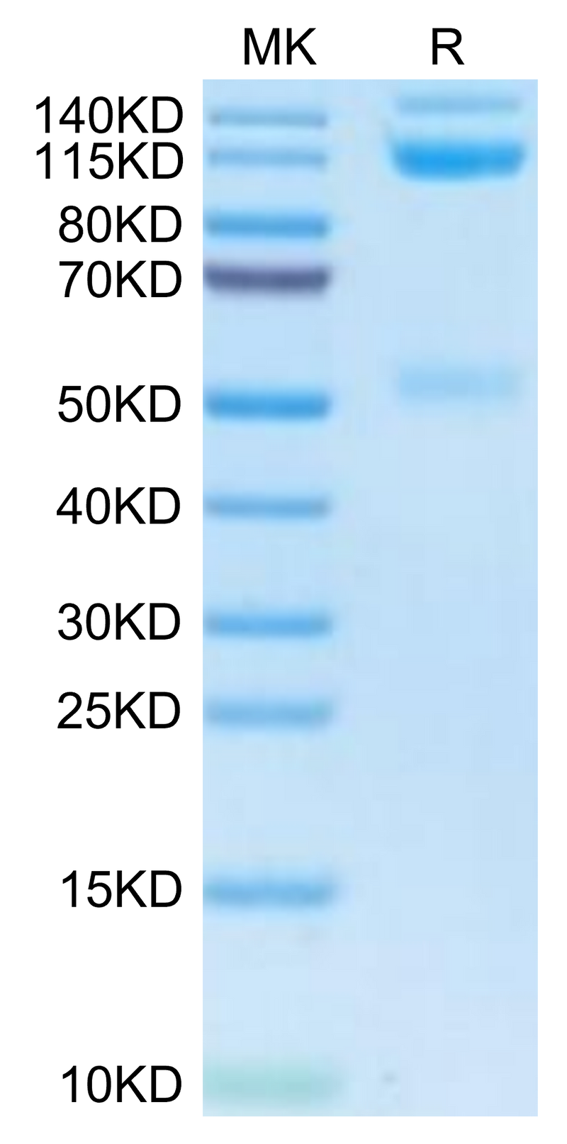 Human ITGAV&ITGB3 on Tris-Bis PAGE under reduced condition. The purity is greater than 95%.Recombinant Human Integrin alpha V beta 3 (ITGAV&ITGB3) Heterodimer Protein, Active