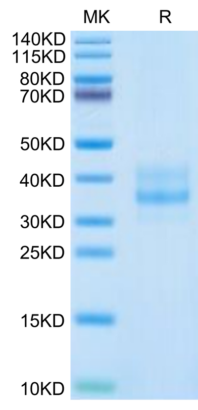 Human CDH17 Domain 1&2 on Tris-Bis PAGE under reduced condition. The purity is greater than 95%.Recombinant Human CDH17/Cadherin 17 Domain 1&2 Protein, Active