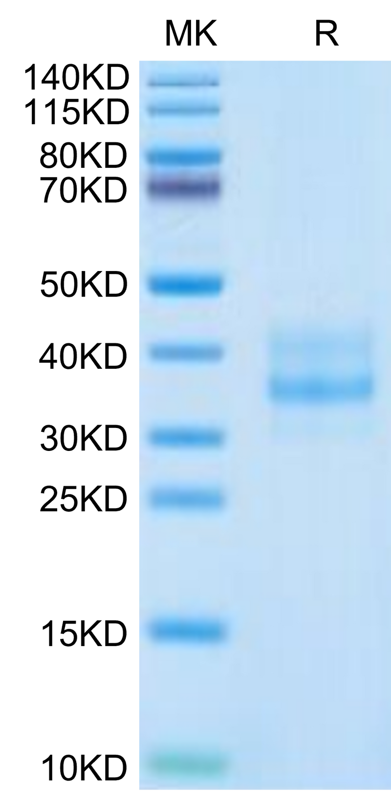 Human CDH17 Domain 1&2 on Tris-Bis PAGE under reduced condition. The purity is greater than 95%.Recombinant Human CDH17/Cadherin 17 Domain 1&2 Protein, Active