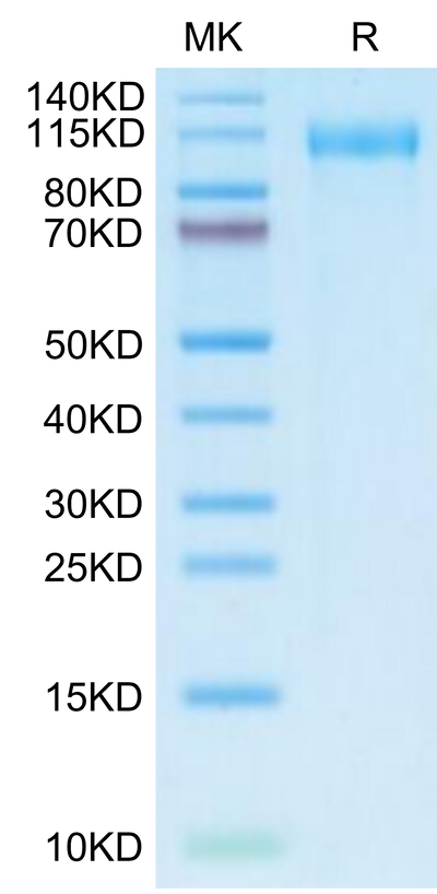 SARS-CoV-2 Spike S1 (Omicron BA.2.12.1) on Tris-Bis PAGE under reduced condition. The purity is greater than 95%.Recombinant SARS-CoV-2 Spike S1 (Omicron BA.2.12.1) Protein, Active