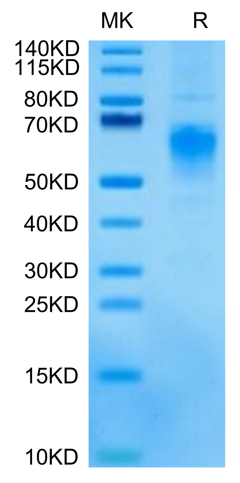 Cynomolgus CRTAM on Tris-Bis PAGE under reduced condition. The purity is greater than 95%.Recombinant Cynomolgus CRTAM Protein, Active