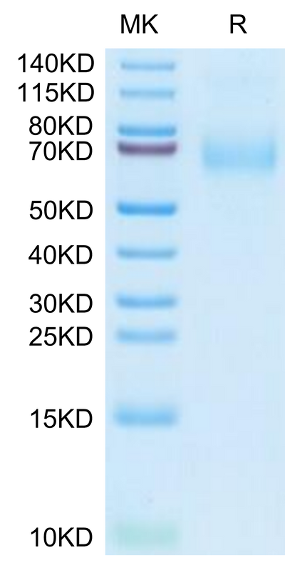 Human MSR1 on Tris-Bis PAGE under reduced condition. The purity is greater than 95%.Recombinant Human MSR1 Protein
