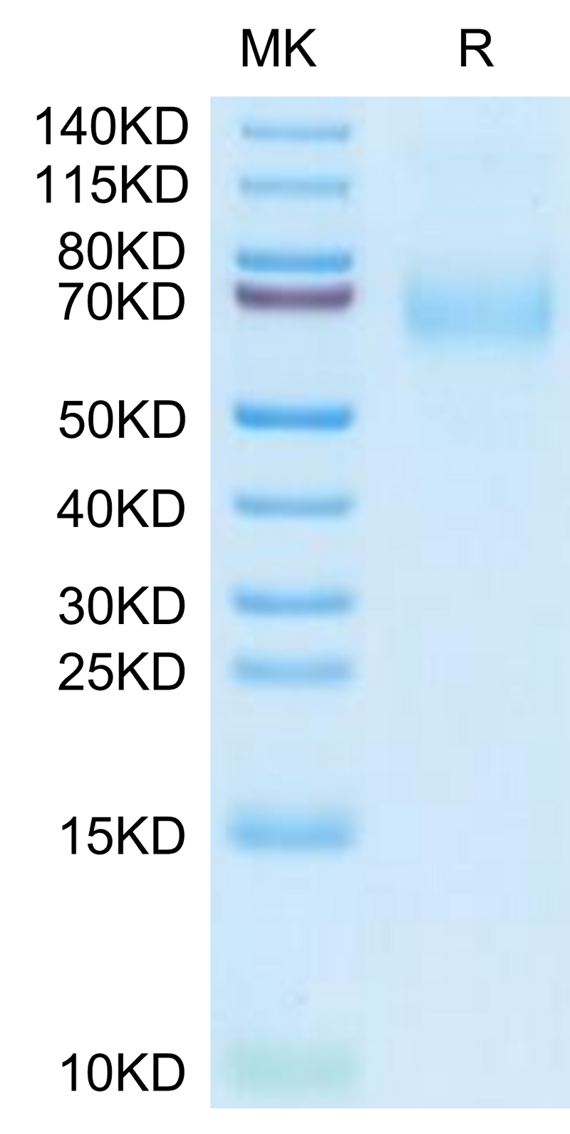 Human MSR1 on Tris-Bis PAGE under reduced condition. The purity is greater than 95%.Recombinant Human MSR1 Protein