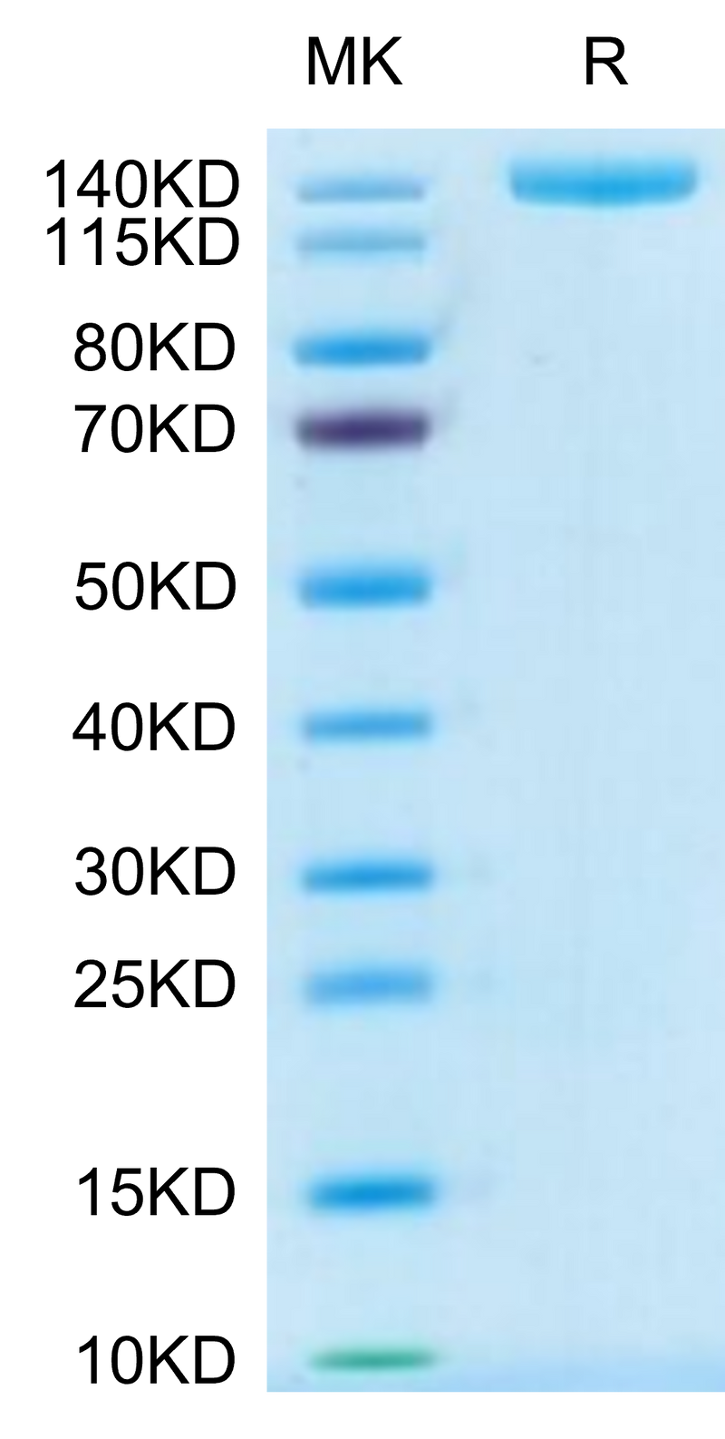 Mouse PLXNA1 on Tris-Bis PAGE under reduced condition. The purity is greater than 95%.Recombinant Mouse PLXNA1 Protein