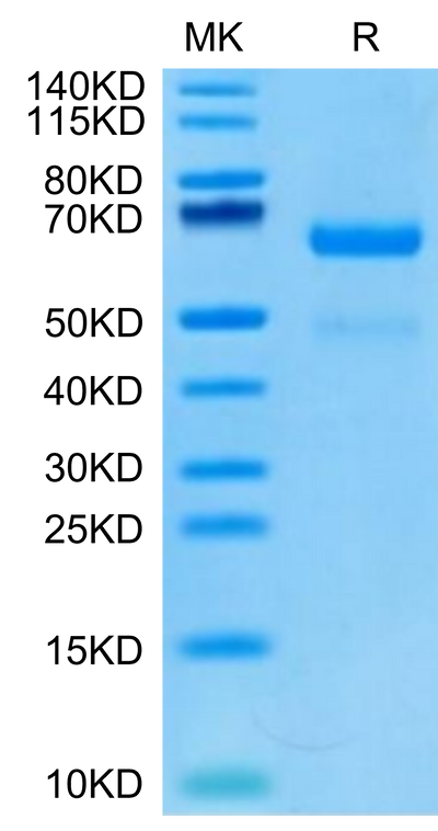 Human LRP10 on Tris-Bis PAGE under reduced condition. The purity is greater than 95%.Recombinant Human LRP10 Protein