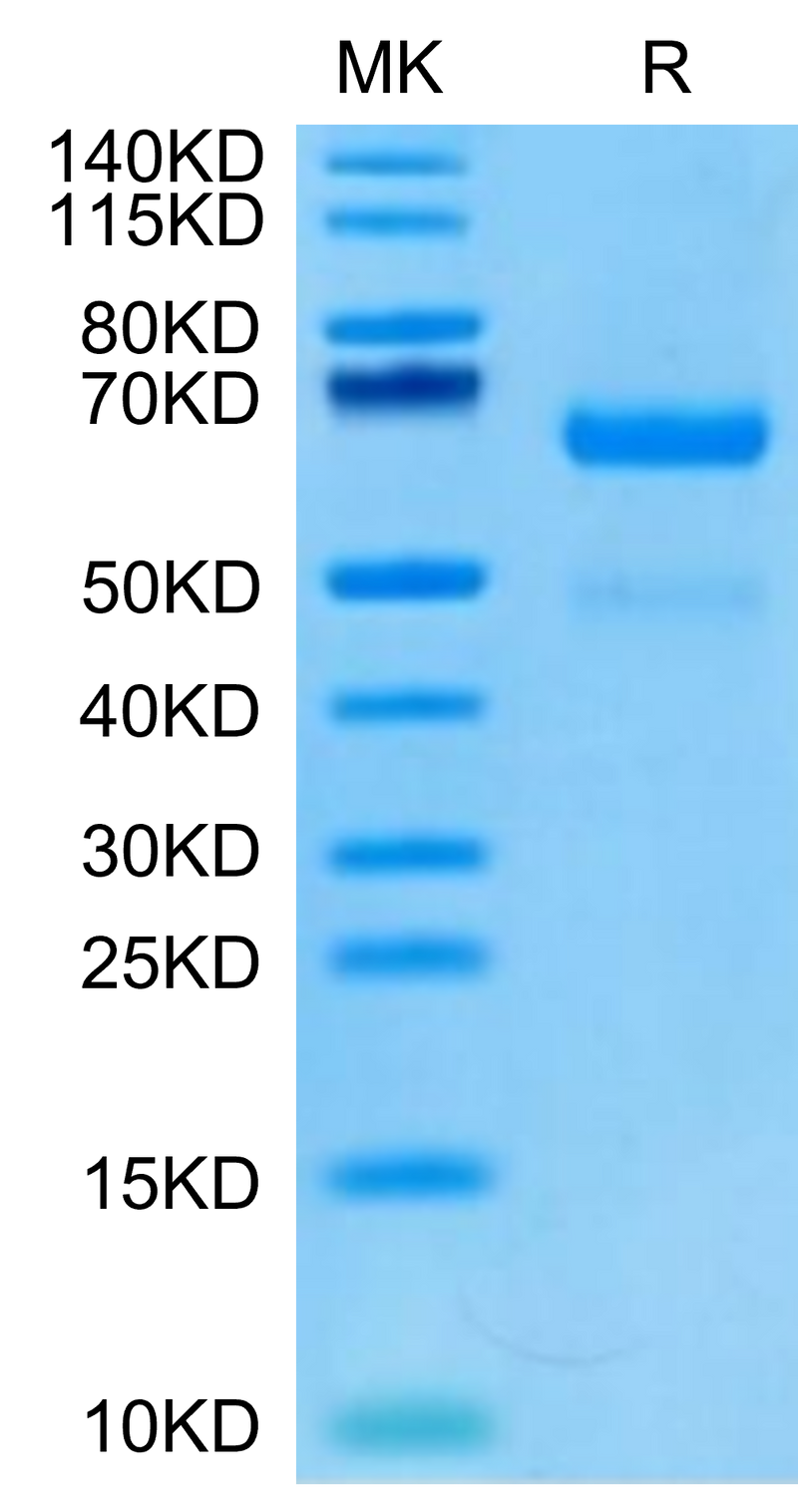 Human LRP10 on Tris-Bis PAGE under reduced condition. The purity is greater than 95%.Recombinant Human LRP10 Protein