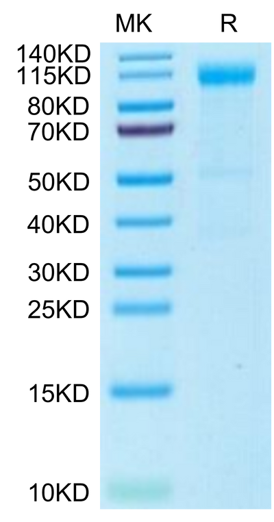 Rhesus macaque Siglec-2 on Tris-Bis PAGE under reduced condition. The purity is greater than 95%.Recombinant Rhesus macaque Siglec-2/CD22 Protein