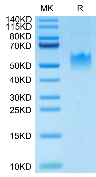 Human PVRIG on Tris-Bis PAGE under reduced condition. The purity is greater than 95%.Recombinant Human PVRIG Protein, Active
