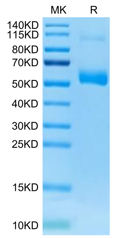 Human PLVAP on Tris-Bis PAGE under reduced condition. The purity is greater than 95%.Recombinant Human PLVAP Protein