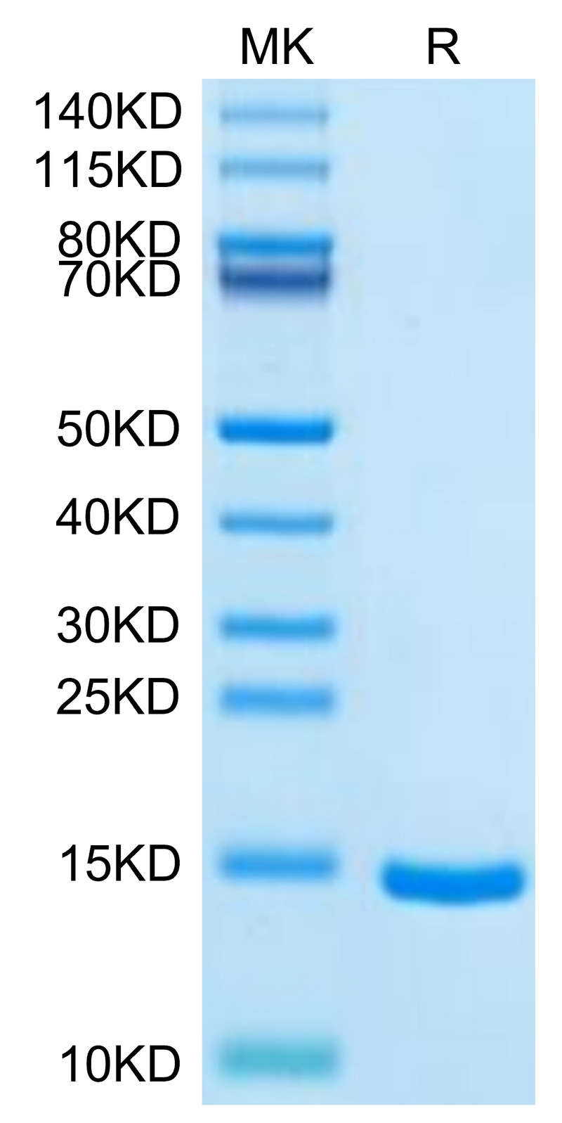Cynomolgus DDT on Tris-Bis PAGE under reduced condition. The purity is greater than 95%.Recombinant Cynomolgus DDT Protein