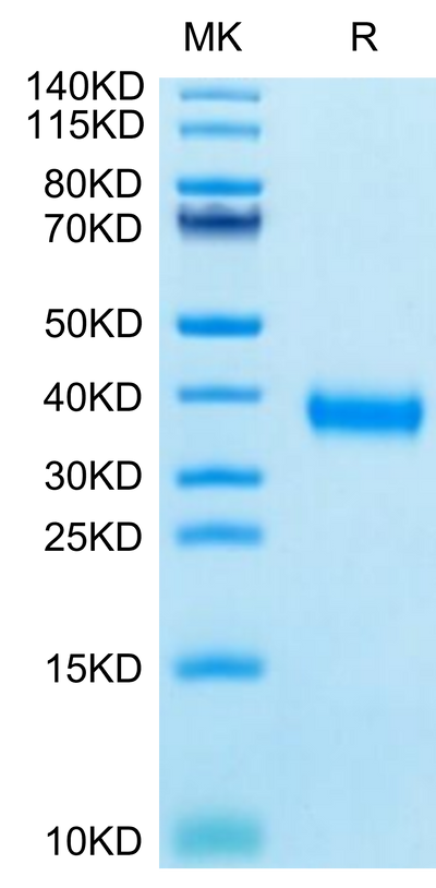 SARS-CoV-2 Spike RBD (Gamma P.1/P.1.1/P.1.2) on Tris-Bis PAGE under reduced condition. The purity is greater than 95%.Recombinant SARS-CoV-2 Spike RBD (Gamma P.1/P.1.1/P.1.2) Protein, Active