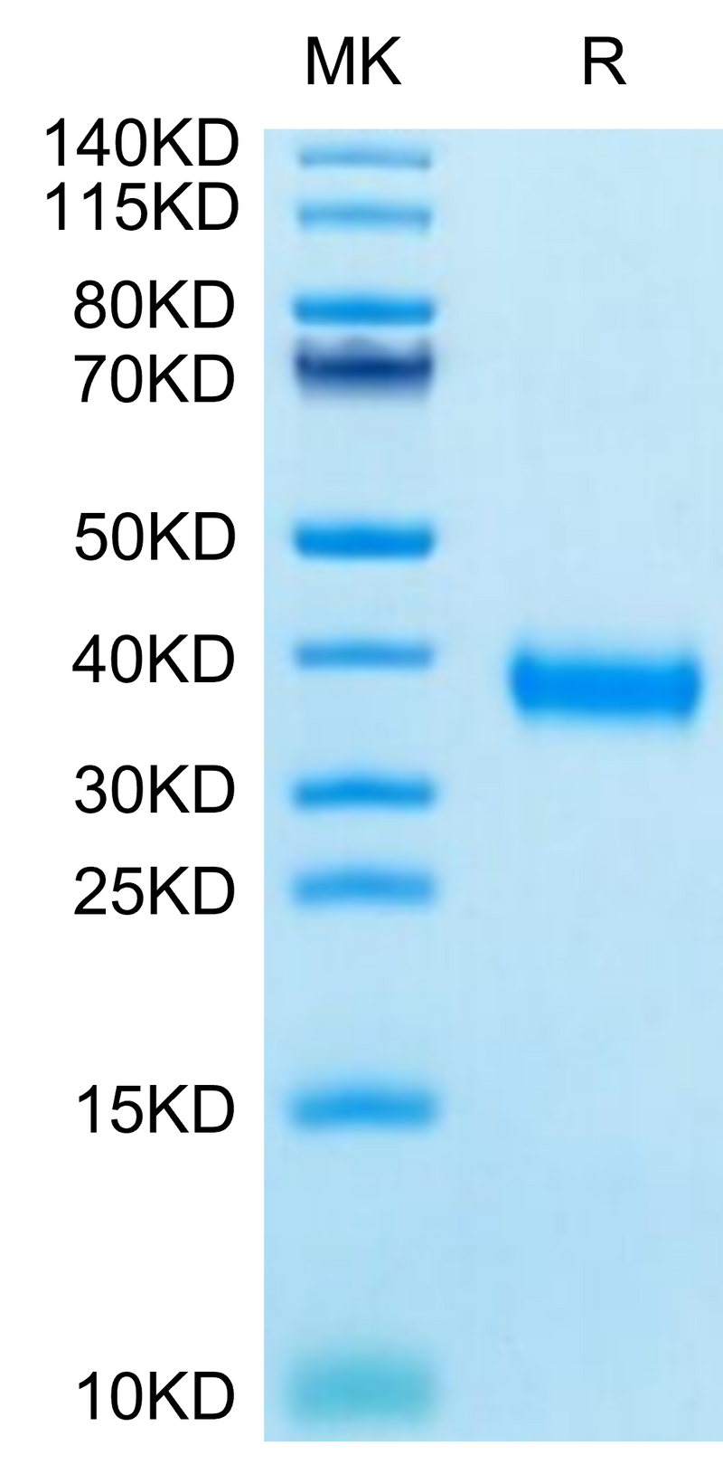 SARS-CoV-2 Spike RBD (Gamma P.1/P.1.1/P.1.2) on Tris-Bis PAGE under reduced condition. The purity is greater than 95%.Recombinant SARS-CoV-2 Spike RBD (Gamma P.1/P.1.1/P.1.2) Protein, Active
