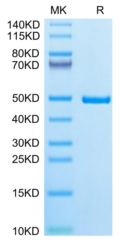 Human IDH1 on Tris-Bis PAGE under reduced condition. The purity is greater than 95%.Recombinant Human IDH1 Protein