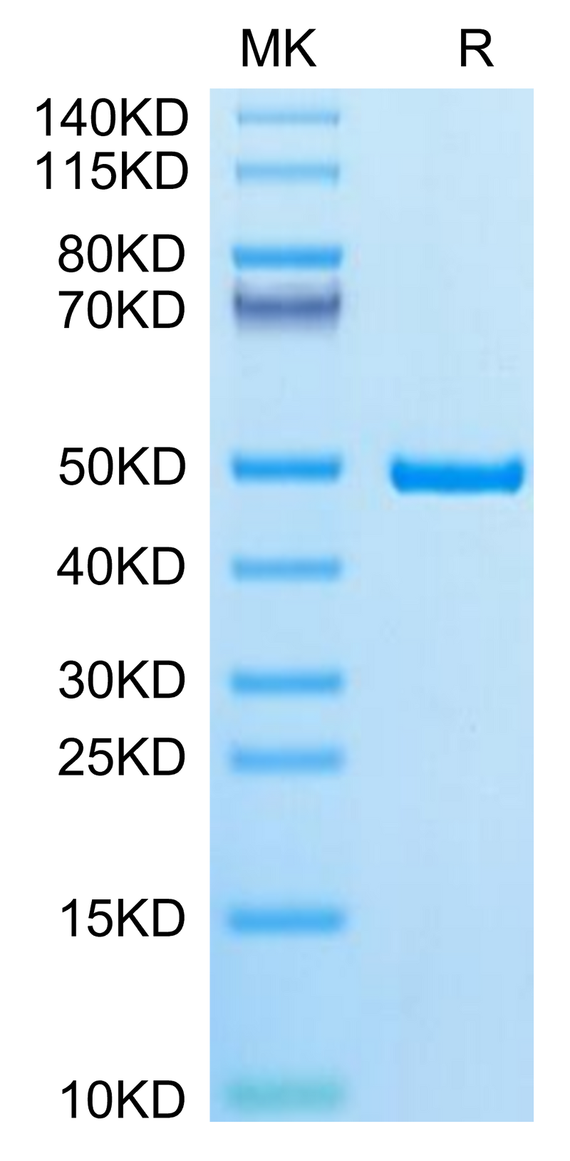 Human IDH1 on Tris-Bis PAGE under reduced condition. The purity is greater than 95%.Recombinant Human IDH1 Protein