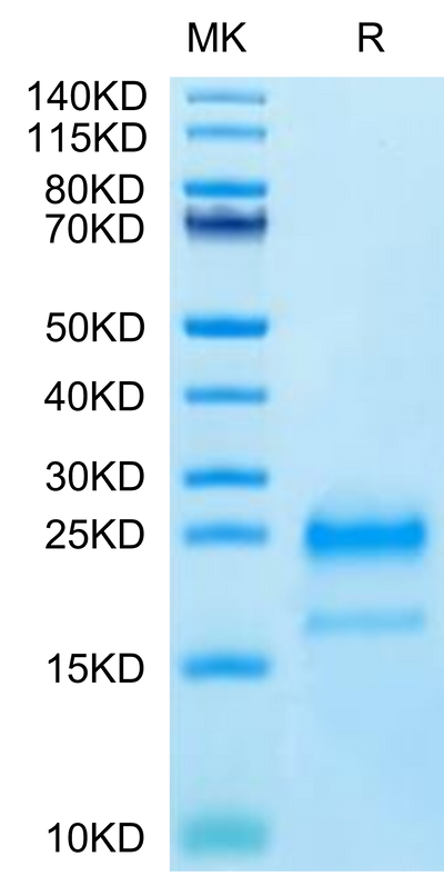 Cynomolgus IL-4 on Tris-Bis PAGE under reduced condition. The purity is greater than 95%.Recombinant Cynomolgus IL-4 Protein, Active