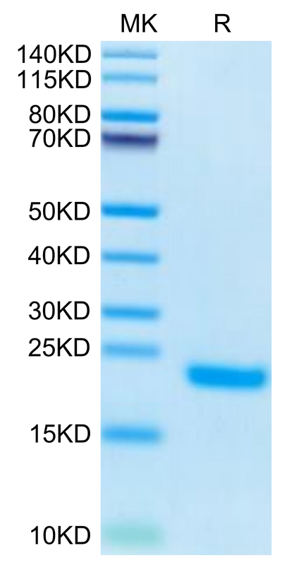 Human PLA2G1B on Tris-Bis PAGE under reduced condition. The purity is greater than 95%.Recombinant Human PLA2G1B Protein