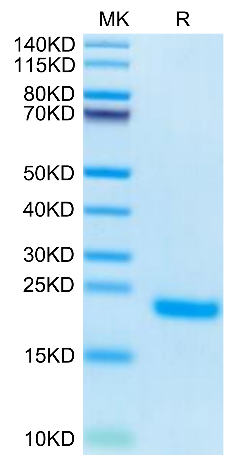 Human PLA2G1B on Tris-Bis PAGE under reduced condition. The purity is greater than 95%.Recombinant Human PLA2G1B Protein