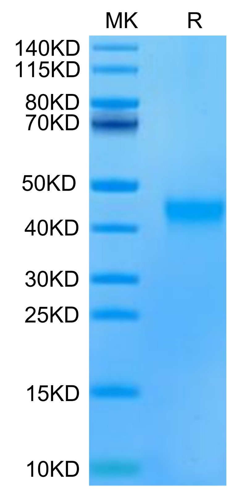 Human/Cynomolgus EFNA3 on Tris-Bis PAGE under reduced condition. The purity is greater than 95%.Recombinant Human/Cynomolgus EFNA3/Ephrin A3 Protein