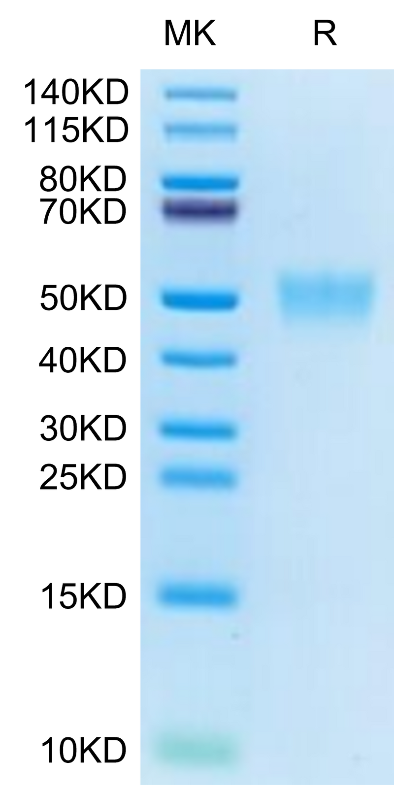 Cynomolgus CD200 on Tris-Bis PAGE under reduced condition. The purity is greater than 95%.Recombinant Cynomolgus CD200/OX-2 Protein, Active