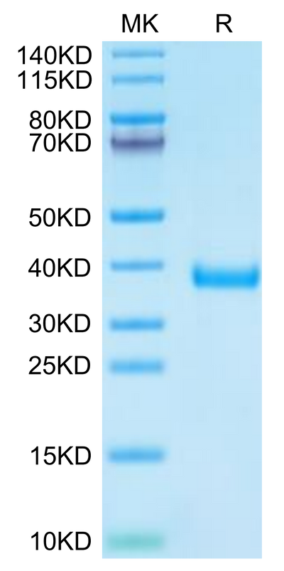 Cynomolgus MFAP4 on Tris-Bis PAGE under reduced condition. The purity is greater than 95%.Recombinant Cynomolgus MFAP4 Protein, Active