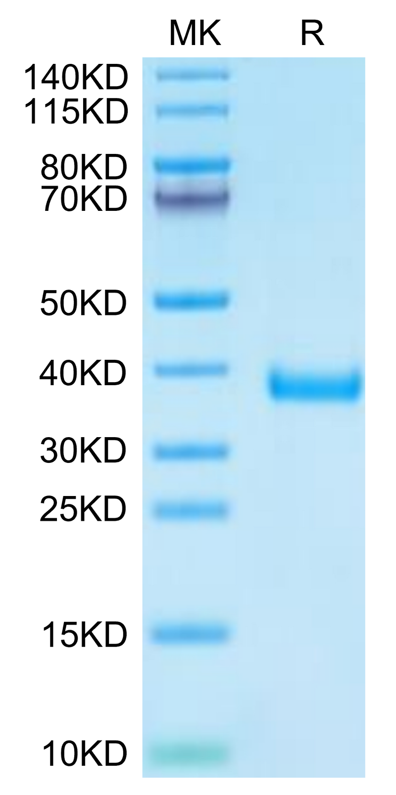Cynomolgus MFAP4 on Tris-Bis PAGE under reduced condition. The purity is greater than 95%.Recombinant Cynomolgus MFAP4 Protein, Active