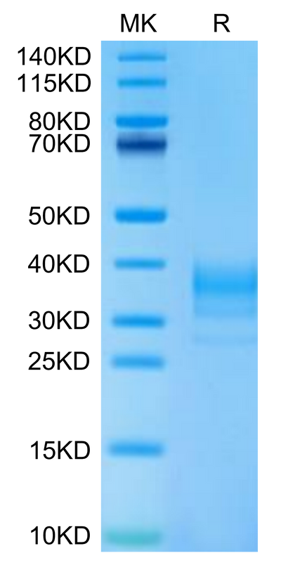 Human LAMP5 on Tris-Bis PAGE under reduced condition. The purity is greater than 95%.Recombinant Human LAMP5 Protein