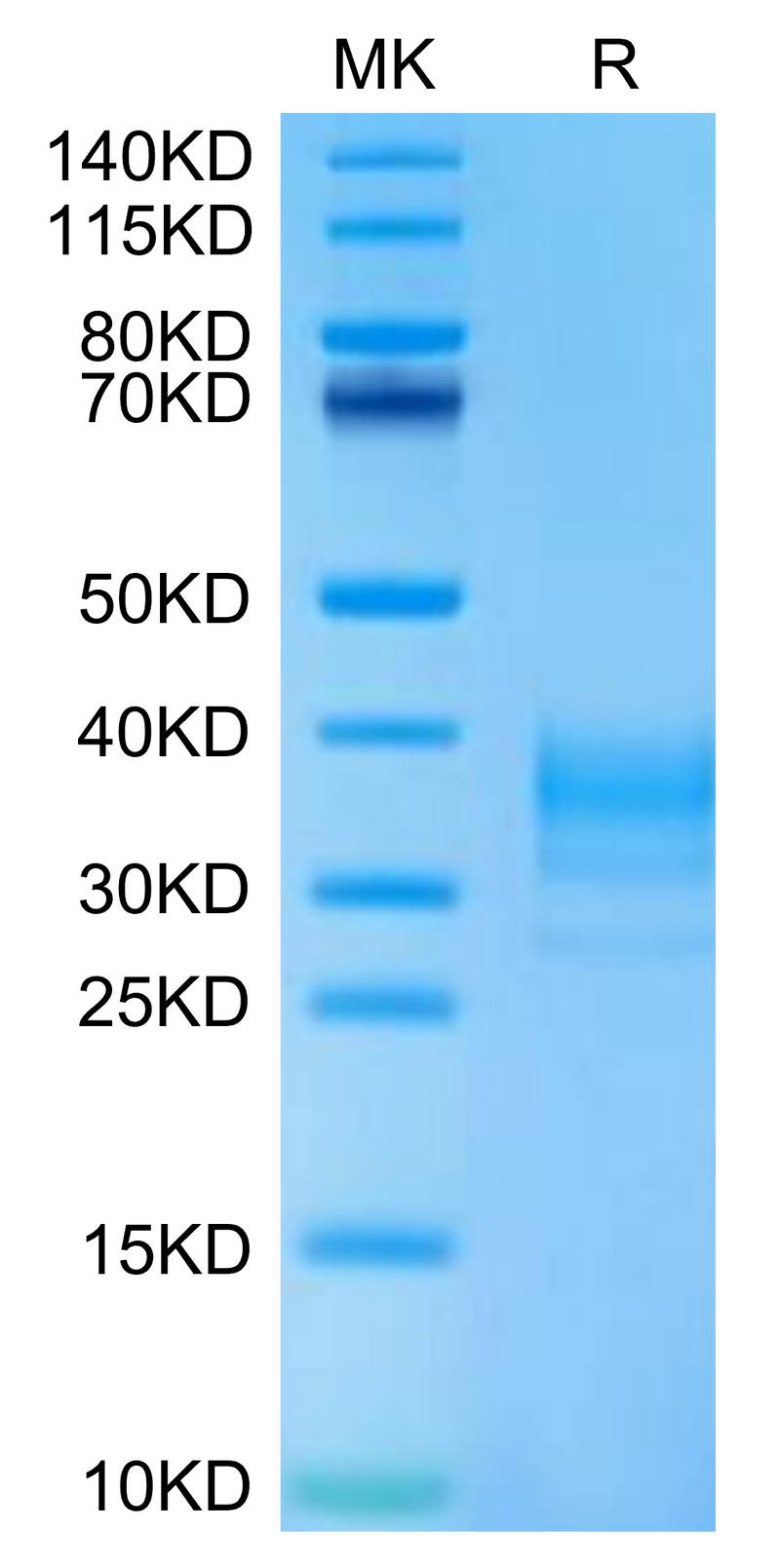 Human LAMP5 on Tris-Bis PAGE under reduced condition. The purity is greater than 95%.Recombinant Human LAMP5 Protein
