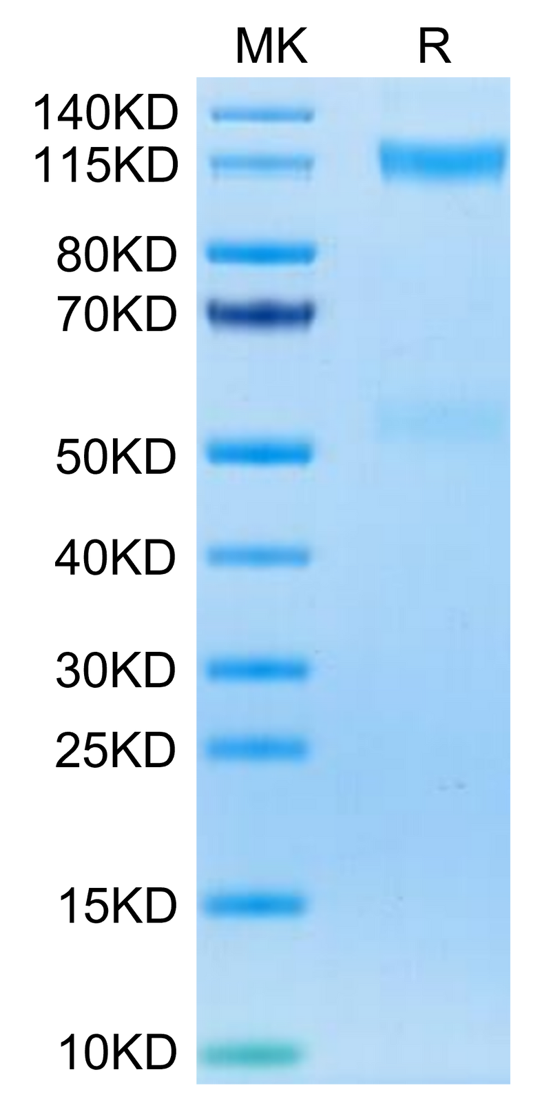 Human IGF1R on Tris-Bis PAGE under reduced condition. The purity is greater than 95%.Recombinant Human IGF1R/CD221 Protein, Active