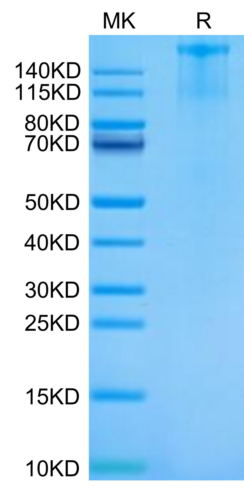 Cynomolgus FLT3 on Tris-Bis PAGE under reduced condition. The purity is greater than 95%.Recombinant Cynomolgus FLT3/Flk-2 Protein, Active