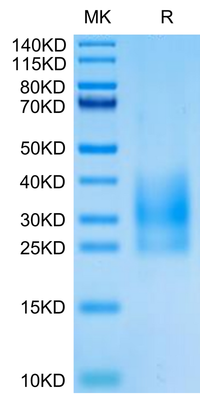 Cynomolgus CD83 on Tris-Bis PAGE under reduced condition. The purity is greater than 95%.Recombinant Cynomolgus CD83 Protein, Active