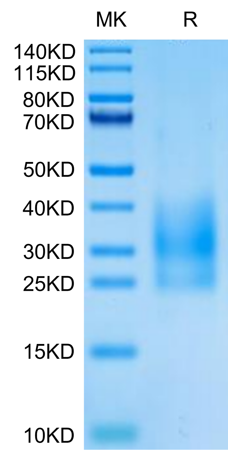 Cynomolgus CD83 on Tris-Bis PAGE under reduced condition. The purity is greater than 95%.Recombinant Cynomolgus CD83 Protein, Active