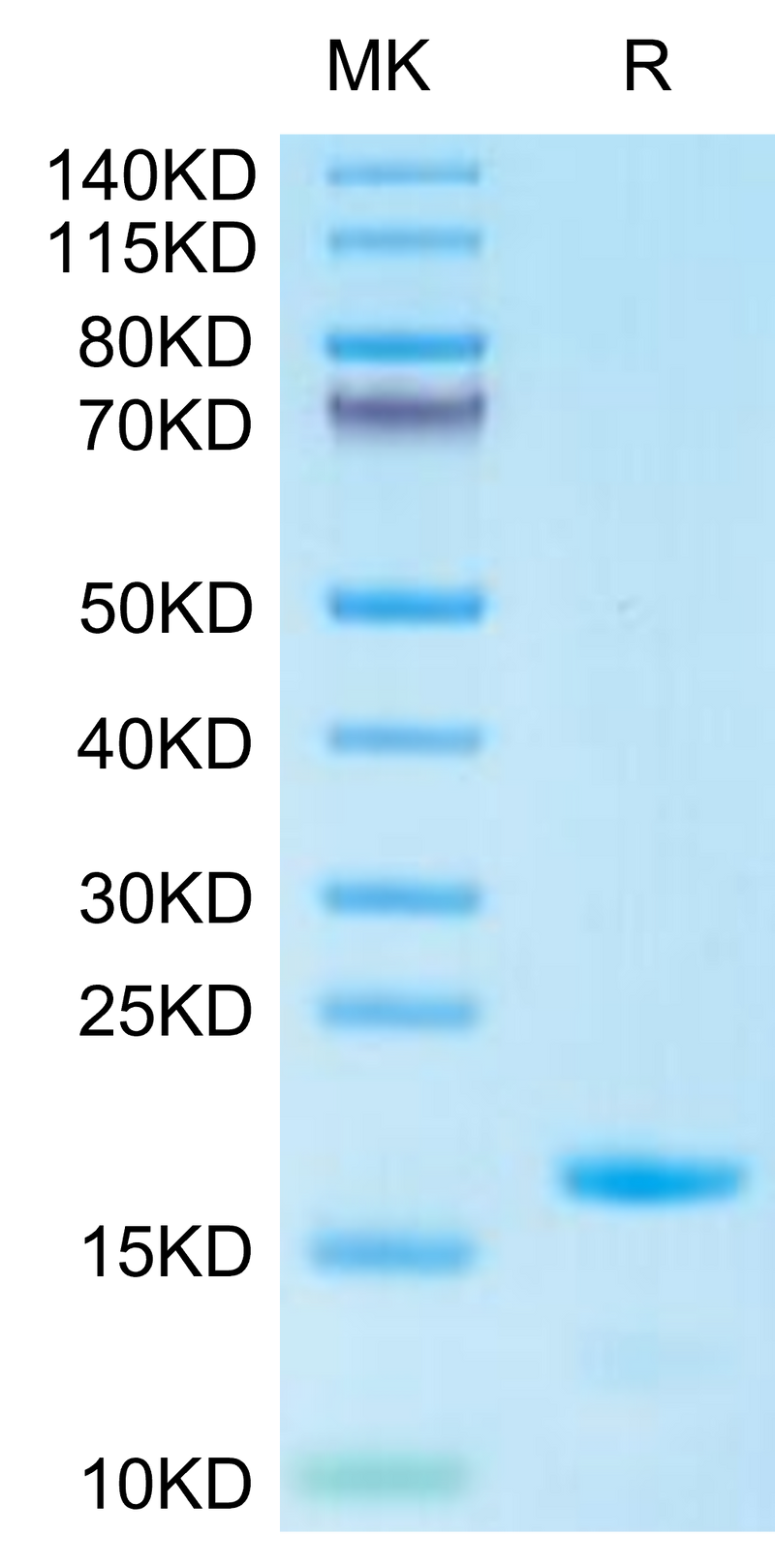 Cynomolgus IL-3 on Tris-Bis PAGE under reduced condition. The purity is greater than 95%.Recombinant Cynomolgus IL-3 Protein, Active