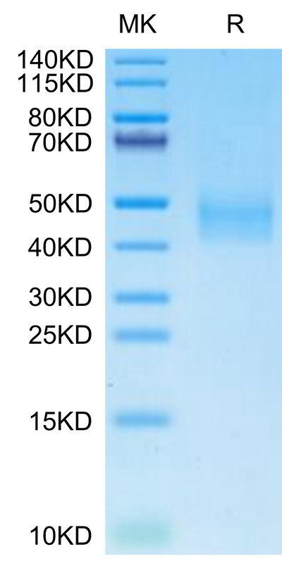 Cynomolgus DLK1 on Tris-Bis PAGE under reduced condition. The purity is greater than 95%.Recombinant Cynomolgus DLK1 Protein