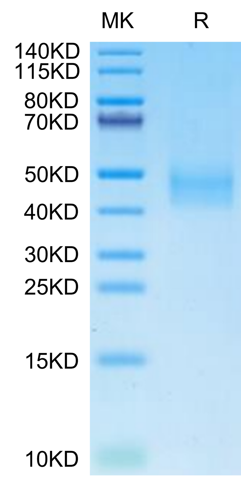 Cynomolgus DLK1 on Tris-Bis PAGE under reduced condition. The purity is greater than 95%.Recombinant Cynomolgus DLK1 Protein