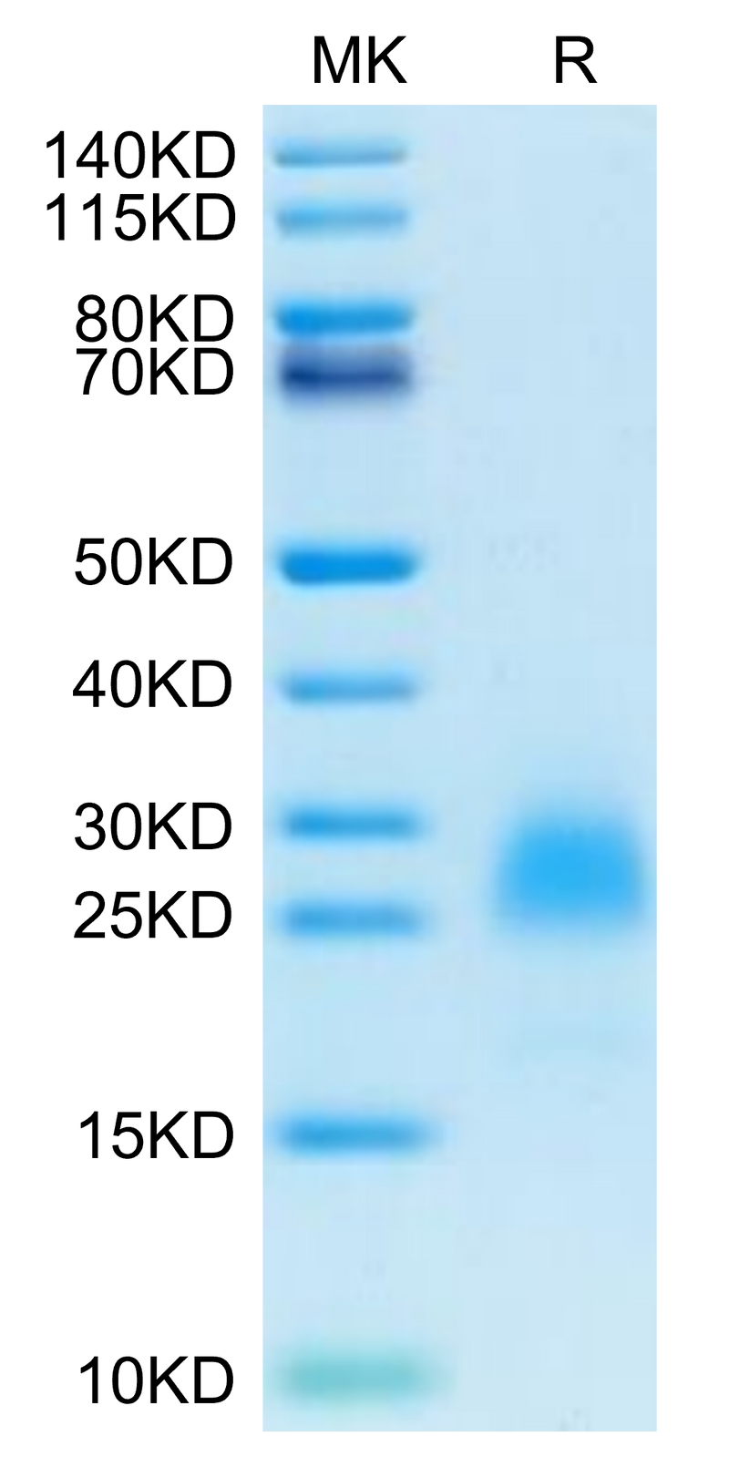 Cynomolgus PVRIG on Tris-Bis PAGE under reduced condition. The purity is greater than 95%.Recombinant Cynomolgus PVRIG Protein, Active