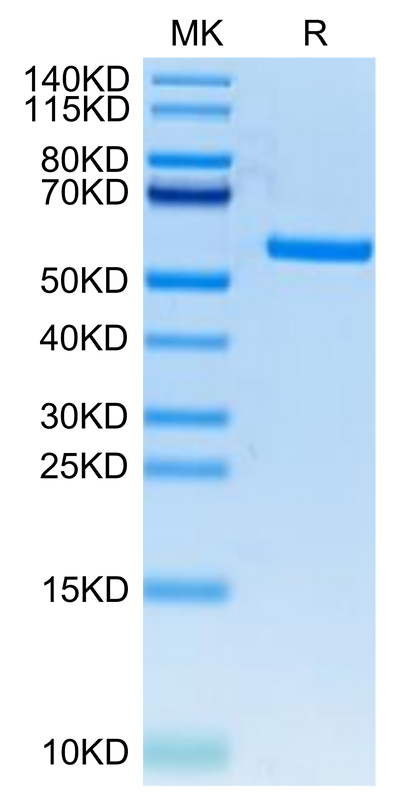FITC-Labeled Human HLA-A*11:01&B2M&KRAS WT (VVVGAGGVGK) Monomer on Tris-Bis PAGE under reduced condition. The purity is greater than 95%.Recombinant FITC-Labeled Human HLA-A*11:01&B2M&KRAS WT (VVVGAGGVGK) Monomer Protein